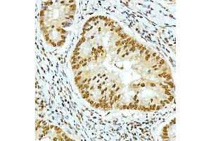 Immunohistochemistry of paraffin-embedded mouse spleen using IFN Rabbit pAb (ABIN7267947) at dilution of 1:100 (40x lens).