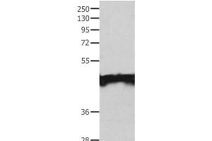Western Blot analysis of Jurkat cell using MAT1A Polyclonal Antibody at dilution of 1:200 (MAT1A anticorps)