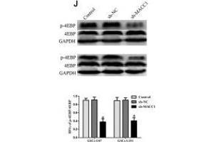 EMAP-II in combination with TMZ induced GSCs autophagy through MACC1 inhibiting PI3K/AKT/mTOR signaling pathway.
