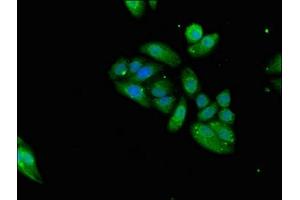Immunofluorescent analysis of HepG2 cells using ABIN7161085 at dilution of 1:100 and Alexa Fluor 488-congugated AffiniPure Goat Anti-Rabbit IgG(H+L)