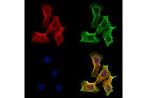 ABIN6264780 and ABIN6273155 staining Hela cells by IF/ICC.