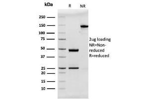 SDS-PAGE Analysis Purified MUC2 Recombinant Mouse Monoclonal Antibody (rMLP/842).
