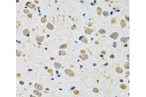 Immunohistochemistry of paraffin-embedded Rat brain using EPHA2 Polyclonal Antibody at dilution of 1:100 (40x lens). (EPH Receptor A2 anticorps)