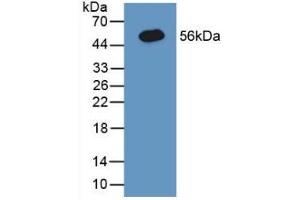 Detection of Recombinant CNX, Human using Polyclonal Antibody to Calnexin (CNX)
