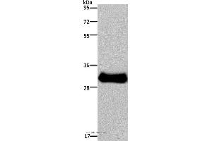 Western blot analysis of Mouse skeletal muscle tissue, using FHL3 Polyclonal Antibody at dilution of 1:1600