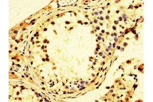 Immunohistochemistry of paraffin-embedded human testis tissue using ABIN7142230 at dilution of 1:100 (PSMC3 anticorps  (Regulatory Subunit 6A))