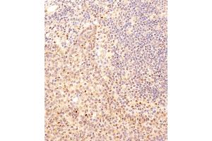 Immunohistochemical analysis of B on paraffin-embedded human tonsil tissue was performed on the Leica®BOND RXm. (SMAD2 anticorps  (AA 201-230))
