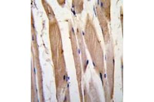 Formalin-fixed and paraffin-embedded human skeletal muscle tissue reacted with VINC antibody (N-term) , which was peroxidase-conjugated to the secondary antibody, followed by DAB staining. (Vinculin anticorps  (N-Term))