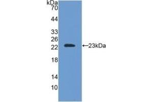 Detection of Recombinant SOD2, Mouse using Polyclonal Antibody to Superoxide Dismutase 2, Mitochondrial (SOD2) (SOD2 anticorps  (AA 25-222))