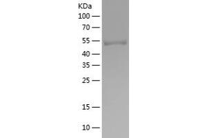Western Blotting (WB) image for Nuclear Factor-kB p65 (NFkBP65) (AA 1-220) protein (His-IF2DI Tag) (ABIN7125273)
