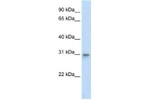 WB Suggested Anti-TFAM Antibody Titration:  2 ug/ml  ELISA Titer:  1:62500  Positive Control:  Human Liver