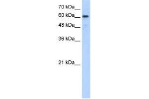 WB Suggested Anti-ADAM30 Antibody Titration:  5. (ADAM30 anticorps  (N-Term))