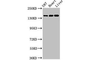 Western Blot Positive WB detected in: U87 whole cell lysate, Rat heart tissue, Mouse liver tissue All lanes: GRIN2A antibody at 3.