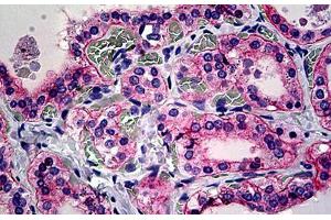 Human Thyroid: Formalin-Fixed, Paraffin-Embedded (FFPE)