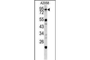 Western blot analysis of CALD1 antibody in A2058 cell line lysates (35ug/lane) (Caldesmon anticorps  (AA 428-457))