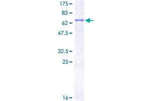 Image no. 1 for Plasminogen Activator Inhibitor 1 (SERPINE1) (AA 1-402) protein (GST tag) (ABIN1319636)