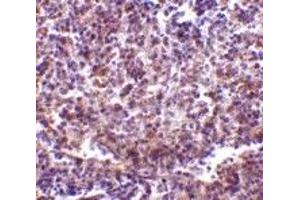 Immunohistochemistry (IHC) image for anti-CD180 Molecule (CD180) (N-Term) antibody (ABIN1031545) (CD180 anticorps  (N-Term))