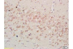 Formalin-fixed and paraffin embedded rat brain tissue labeled Anti-IGFBP3 Polyclonal Antibody, Unconjugated (ABIN686497) at 1:200, followed by conjugation to the secondary antibody and DAB staining (IGFBP3 anticorps  (AA 186-292))