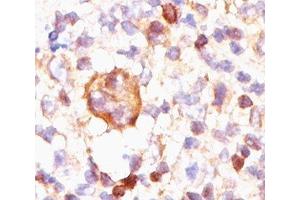 IHC testing of Hodgkin's lymphoma stained with Bcl-X antibody (BX006). (BCL2L1 anticorps)