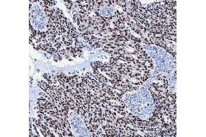 IHC analysis of FEN1 using anti-FEN1 antibody (ABIN7601617). (FEN1 anticorps  (AA 4-300))