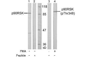 Image no. 3 for anti-Ribosomal Protein S6 Kinase, 90kDa, Polypeptide 1 (RPS6KA1) (pThr348) antibody (ABIN196797)