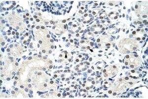 Rabbit Anti-SSB Antibody  Paraffin Embedded Tissue: Human Kidney Cellular Data: Epithelial cells of renal tubule Antibody Concentration: 4.