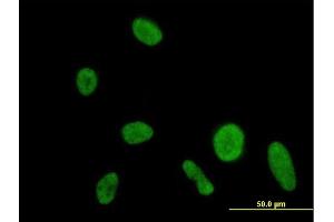 Immunofluorescence of purified MaxPab antibody to DIP2A on HeLa cell.