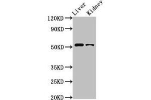 Western Blot Positive WB detected in: Rat liver tissue, Rat kidney tissue All lanes: PTGER4 antibody at 3. (PTGER4 anticorps  (AA 354-472))