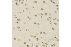 Immunohistochemistry of paraffin-embedded Mouse brain using HNRNPD antibody at dilution of 1:100 (x400 lens). (HNRNPD/AUF1 anticorps)