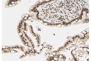 ABIN6266651 at 1/100 staining human colon tissue sections by IHC-P. (NCOR1 anticorps  (N-Term))