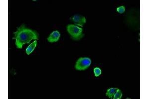 Immunofluorescence staining of MCF-7 cells with ABIN7146799 at 1:133, counter-stained with DAPI. (CEACAM5 anticorps  (AA 1-255))