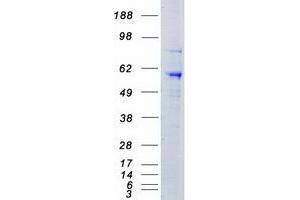 Validation with Western Blot