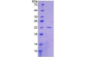 SDS-PAGE of Protein Standard from the Kit (Highly purified E. (CYFRA21.1 Kit CLIA)