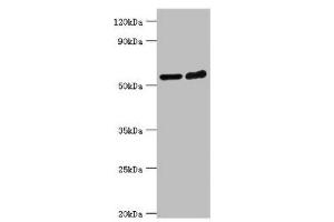 Western blot All lanes: Target of rapamycin complex 2 subunit MAPKAP1 antibody at 2 μg/mL Lane 1: Hela whole cell lysate Lane 2: MCF-7 whole cell lysate Secondary Goat polyclonal to rabbit IgG at 1/10000 dilution Predicted band size: 60, 55, 54, 38, 37, 42 kDa Observed band size: 60 kDa (MAPKAP1 anticorps  (AA 1-290))