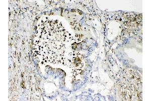 IHC analysis of TMEM107 using anti- TMEM107 antibody . (TMEM107 anticorps  (N-Term))