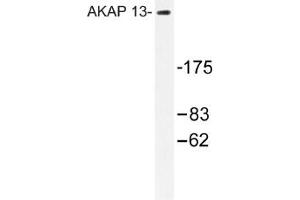 Image no. 1 for anti-A Kinase (PRKA) Anchor Protein 13 (AKAP13) antibody (ABIN317612) (AKAP13 anticorps)
