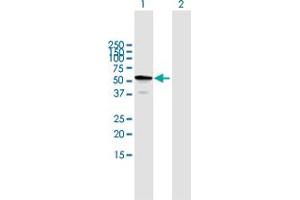 Western Blot analysis of TBC1D22B expression in transfected 293T cell line by TBC1D22B MaxPab polyclonal antibody. (TBC1D22B anticorps  (AA 1-505))