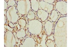 Immunohistochemistry of paraffin-embedded human thyroid tissue using ABIN7153105 at dilution of 1:100 (FOXR2 anticorps  (AA 1-300))