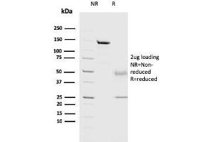 SDS-PAGE Analysis Purified Cathepsin D Mouse Monoclonal Antibody (CTSD/3082). (Cathepsin D anticorps  (AA 104-250))