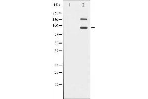 Western blot analysis of IGF1R phosphorylation expression in Insulin treated 293 whole cell lysates,The lane on the left is treated with the antigen-specific peptide.