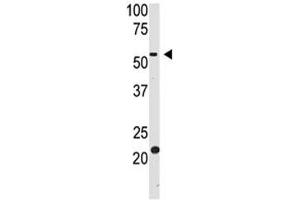 Western blot testing of BACE2 antibody and HL-60 cell lysate