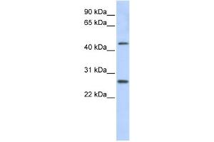 WB Suggested Anti-PRAMEF10 Antibody Titration: 0. (PRAMEF10 anticorps  (Middle Region))