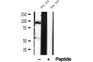 Western blot analysis of extracts of HEK-293 cells, using DACH1 antibody. (DACH1 anticorps  (Internal Region))
