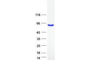 Validation with Western Blot (Asparaginase Protein (Myc-DYKDDDDK Tag))