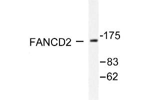 Image no. 3 for anti-Fanconi Anemia, Complementation Group D2 (FANCD2) antibody (ABIN265413) (FANCD2 anticorps)