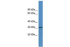 WB Suggested Anti-Auh Antibody Titration:  0. (AUH anticorps  (N-Term))
