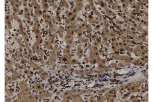 ABIN6273021 at 1/100 staining Human liver tissue by IHC-P. (TRIM44 anticorps  (Internal Region))