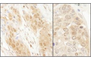 Immunohistochemistry (IHC) image for anti-Parkinson Protein 7 (PARK7) (C-Term) antibody (ABIN7454672) (PARK7/DJ1 anticorps  (C-Term))