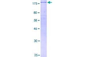 Image no. 1 for Receptor tyrosine-protein kinase erbB-2 (ErbB2/Her2) (AA 1-1255) protein (GST tag) (ABIN1353011)