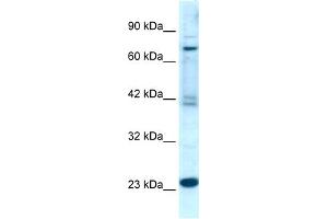 WB Suggested Anti-RGS10  Antibody Titration: 0.
